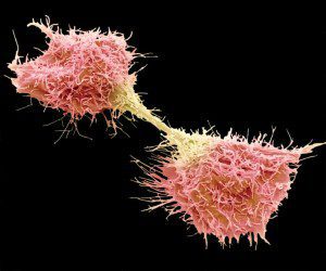 ракови клетки метастази