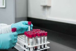 изследване на кръв тест за рак