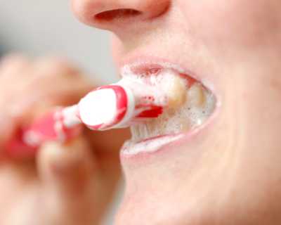 почистване на зъбите плака