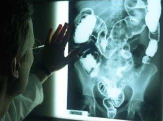Ултрамодерен рентген в урологията тръгва в Пирогов