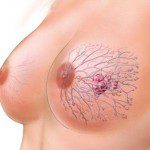 рак на гърдата причини симптоми