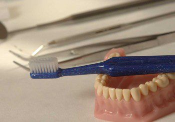 Джобове на зъбите - причини и лечение