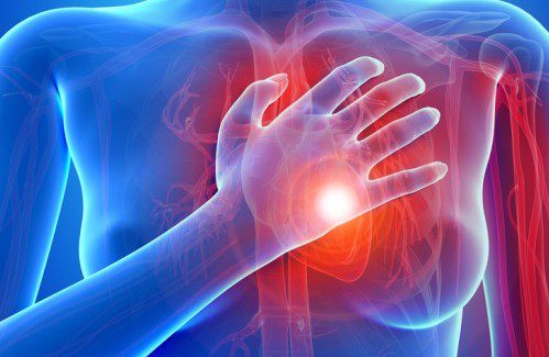 болести на сърцето инфаркт