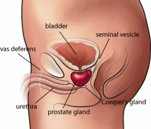 увеличена простата симптоми лечение