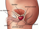 увеличена простата симптоми лечение