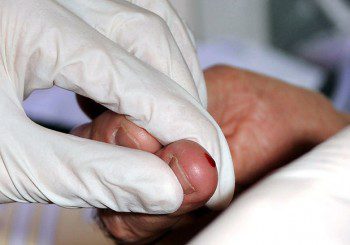Безплатни изследвания за хепатит С по кръв от пръста