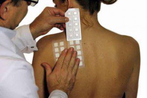 тест на кожата при алергия дерматит екзема
