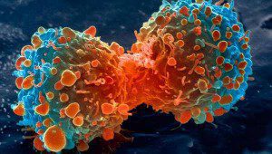 рак ракова клетка