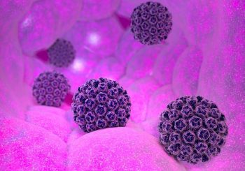 Кога и защо папилома вируси правят рак на гърлото?
