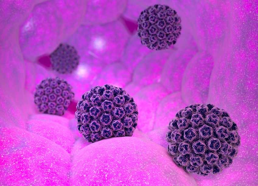 HPV папилома вируси снимка